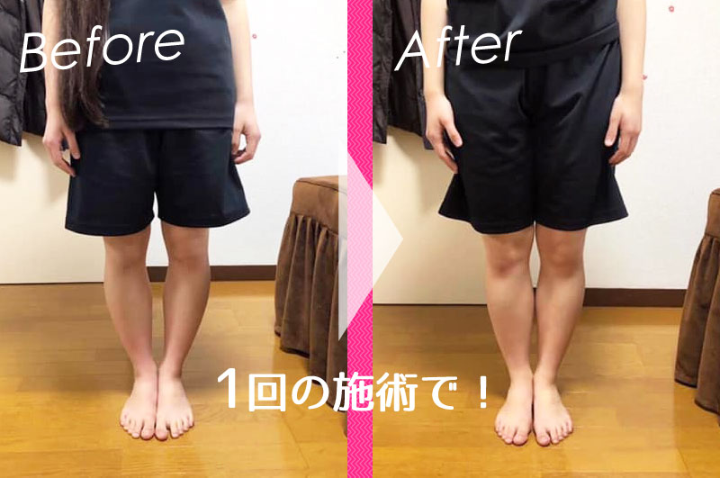 1回の施術でこんなに変わる